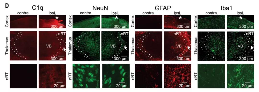 顱腦創(chuàng)傷后的繼發(fā)性腦損傷是怎么發(fā)生的?Science:補體介導炎癥及神經損傷! 顱腦創(chuàng)傷后的繼發(fā)性腦損傷是怎么發(fā)生的?Science:補體介導炎癥及神經損傷!