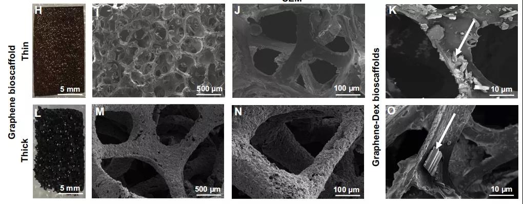 石墨烯 YYDS!Science Advances:石墨烯生物支架用于抑制器官移植的炎癥反應(yīng),提高移植細(xì)胞的生存率 石墨烯 YYDS!Science Advances:石墨烯生物支架用于抑制器官移植的炎癥反應(yīng),提高移植細(xì)胞的生存率