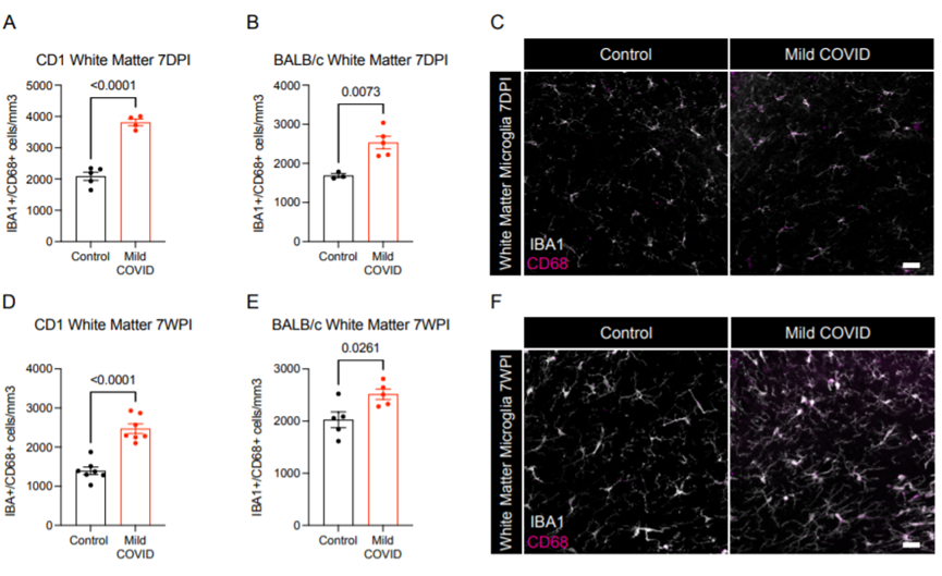 新冠竟能“傷腦”?耶魯科學家找到SARS-CoV-2損害神經系統新證據 新冠竟能“傷腦”?耶魯科學家找到SARS-CoV-2損害神經系統新證據