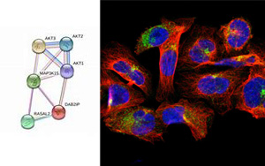 Science Advances:外顯子組測(cè)序研究發(fā)現(xiàn)糖尿病的潛在治療靶點(diǎn) Science Advances:外顯子組測(cè)序研究發(fā)現(xiàn)糖尿病的潛在治療靶點(diǎn)