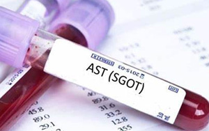 谷草轉氨酶(AST/GOT)檢測試劑盒用原輔料 谷草轉氨酶(AST/GOT)檢測試劑盒用原輔料