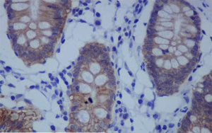 《PNAS》一種不為人知的蛋白質，它能保持人體細胞的健康