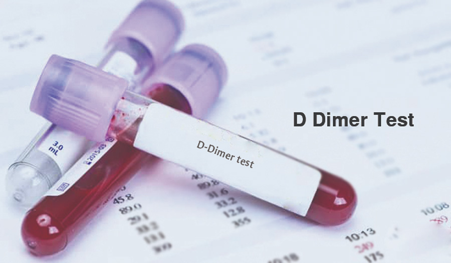 D-二聚體(D-Dimer)-磁微粒化學法學發光(AP/AE) /熒光免疫層析解決方案