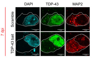 Cell Stem Cell:利用類器官保護癡呆和ALS中受到的腦損傷
