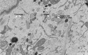 Nature Microbiology:一種以前未知的免疫反應途徑