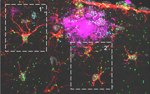 《Nature Neuroscience》可增強神經膠質細胞的蛋白質
